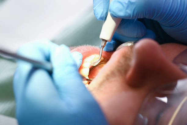 Best Broken Tooth Emergency  in Bellbrook, OH