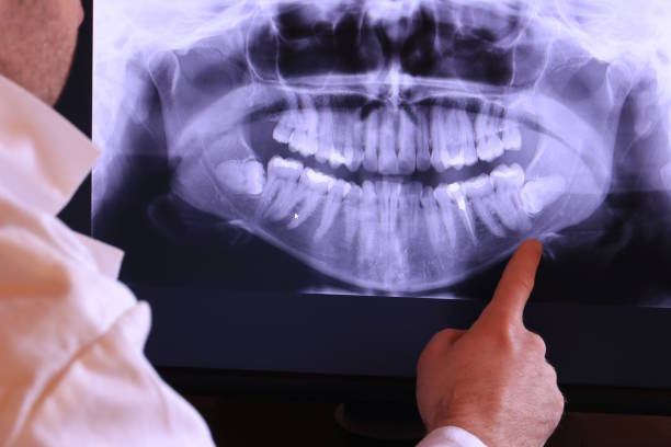 Best Emergency Gum Pain Relief  in Bellbrook, OH